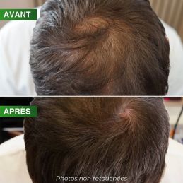 Shampooing BBHair Densité pro 250 ml